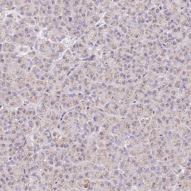 COPZ2 Antibody in Immunohistochemistry (IHC)