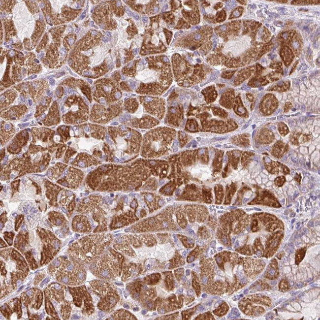 ZNF547 Antibody in Immunohistochemistry (Paraffin) (IHC (P))