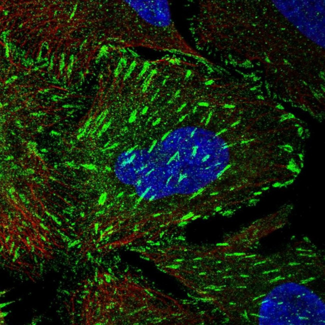 Tensin 3 Antibody in Immunocytochemistry (ICC/IF)