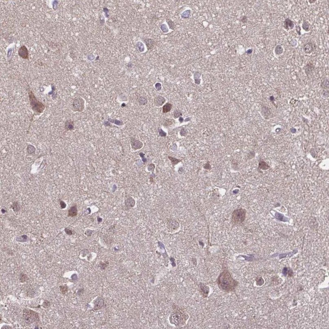 DIP2B Antibody in Immunohistochemistry (IHC)