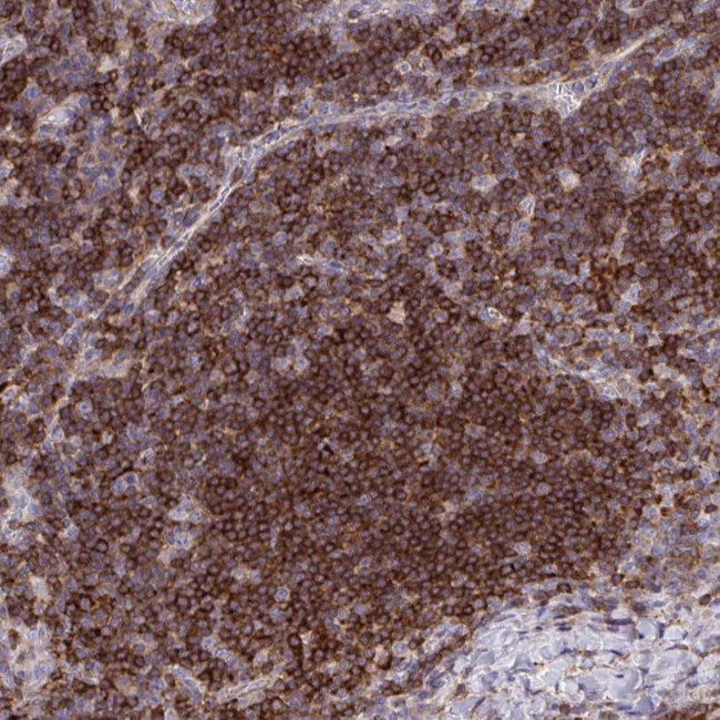 ERI1 Antibody in Immunohistochemistry (Paraffin) (IHC (P))