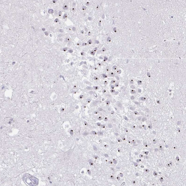 FAM9A Antibody in Immunohistochemistry (Paraffin) (IHC (P))