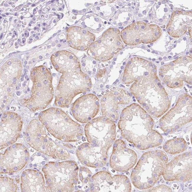 PALM3 Antibody in Immunohistochemistry (IHC)