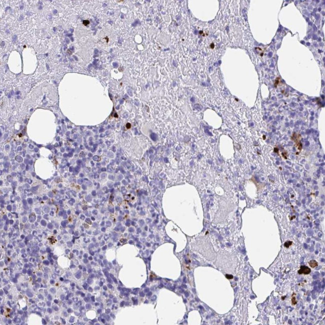 KMT2E Antibody in Immunohistochemistry (Paraffin) (IHC (P))
