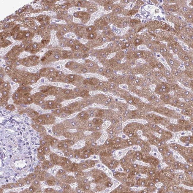 SC4MOL Antibody in Immunohistochemistry (Paraffin) (IHC (P))