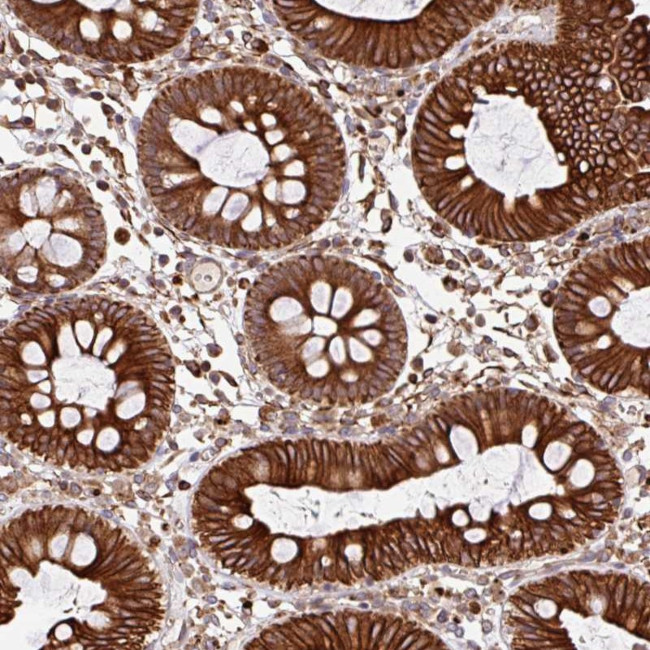ZNF790 Antibody in Immunohistochemistry (Paraffin) (IHC (P))