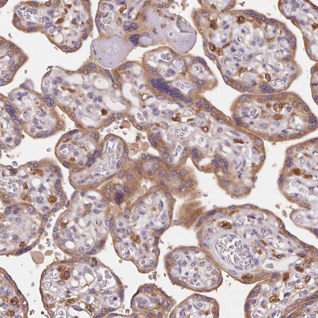 RAB1A Antibody in Immunohistochemistry (Paraffin) (IHC (P))