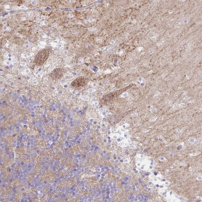 RASL10A Antibody in Immunohistochemistry (Paraffin) (IHC (P))