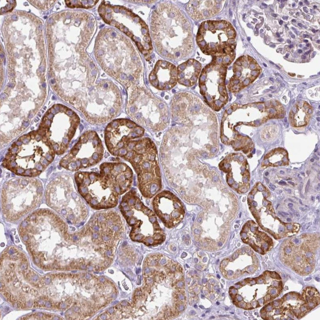 ADAMTS19 Antibody in Immunohistochemistry (Paraffin) (IHC (P))