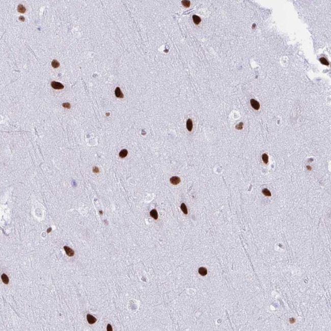 DDX52 Antibody in Immunohistochemistry (Paraffin) (IHC (P))