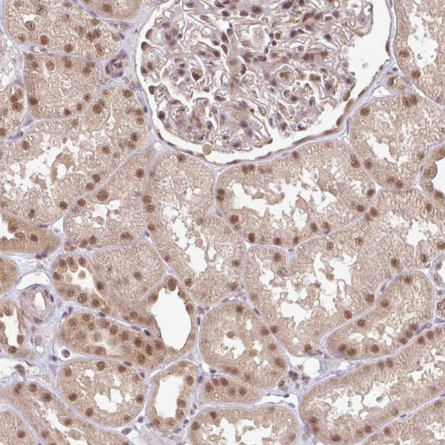 GTF3C6 Antibody in Immunohistochemistry (Paraffin) (IHC (P))