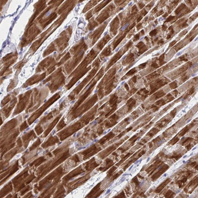 NDUFC2 Antibody in Immunohistochemistry (Paraffin) (IHC (P))