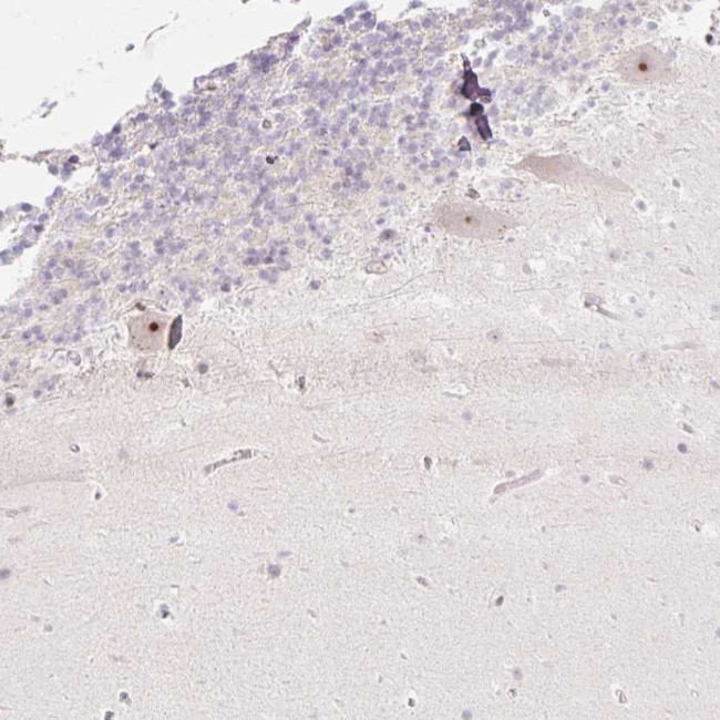 ZNF417 Antibody in Immunohistochemistry (Paraffin) (IHC (P))