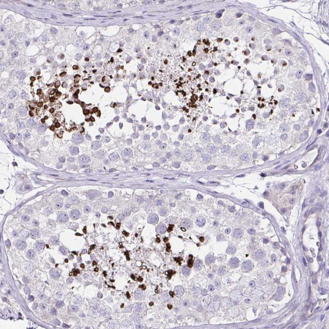 D2HGDH Antibody in Immunohistochemistry (Paraffin) (IHC (P))