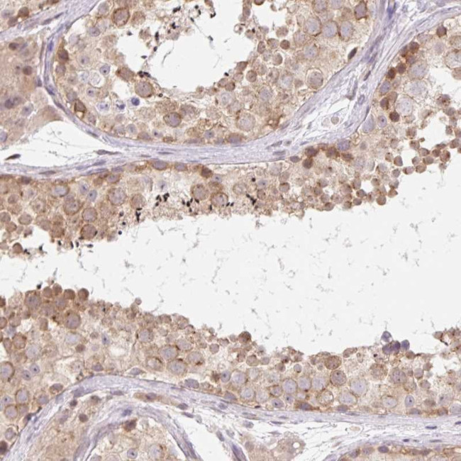 TBPL2 Antibody in Immunohistochemistry (Paraffin) (IHC (P))