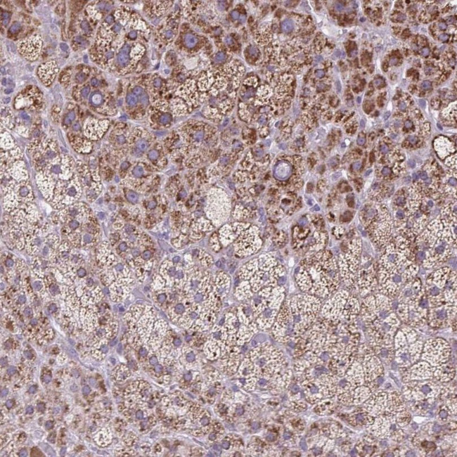 SCO2 Antibody in Immunohistochemistry (IHC)