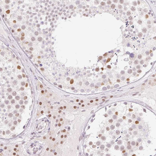 H2BFWT Antibody in Immunohistochemistry (Paraffin) (IHC (P))