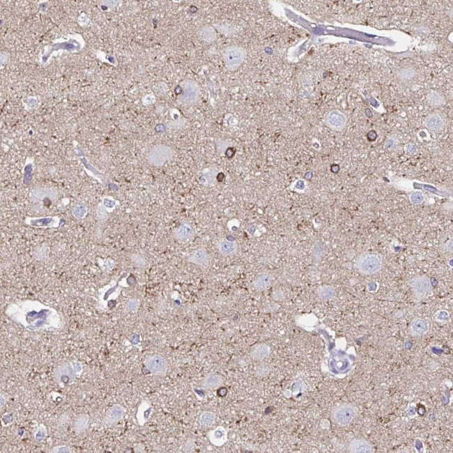 UGT3A1 Antibody in Immunohistochemistry (Paraffin) (IHC (P))
