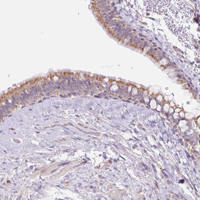ESAM Antibody in Immunohistochemistry (Paraffin) (IHC (P))