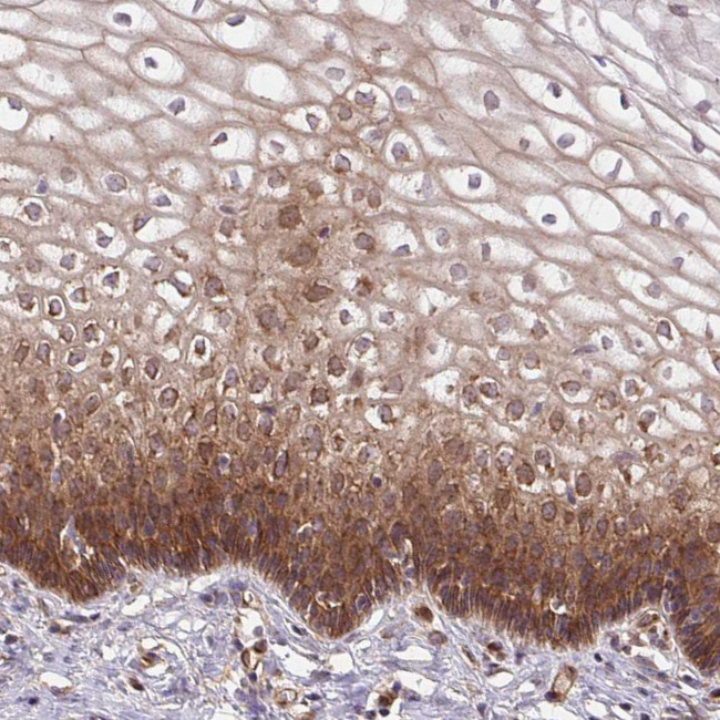 Septin-10 Antibody in Immunohistochemistry (Paraffin) (IHC (P))