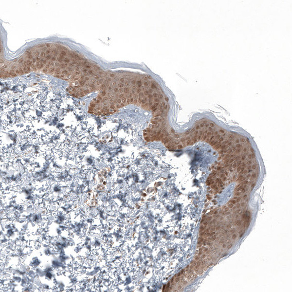 KLHL24 Antibody in Immunohistochemistry (Paraffin) (IHC (P))
