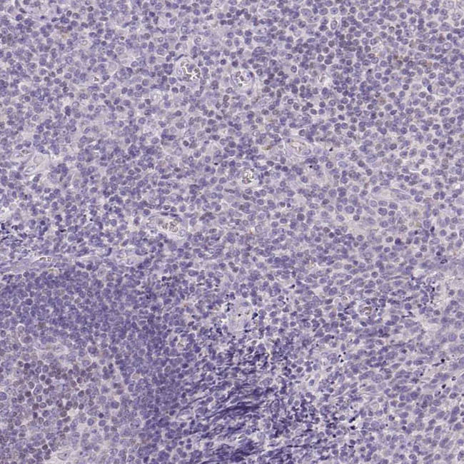 CYP11B1 Antibody in Immunohistochemistry (Paraffin) (IHC (P))