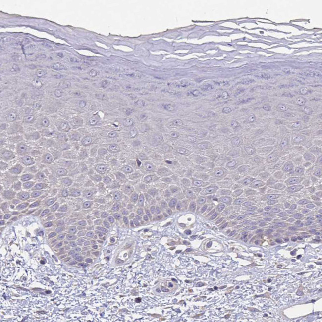 FBXL16 Antibody in Immunohistochemistry (Paraffin) (IHC (P))