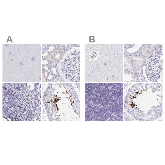 C2orf57 Antibody in Immunohistochemistry (IHC)
