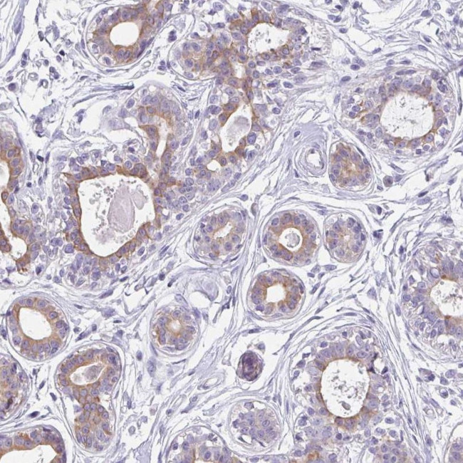 C1QTNF8 Antibody in Immunohistochemistry (Paraffin) (IHC (P))