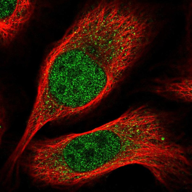 CBX7 Antibody in Immunocytochemistry (ICC/IF)