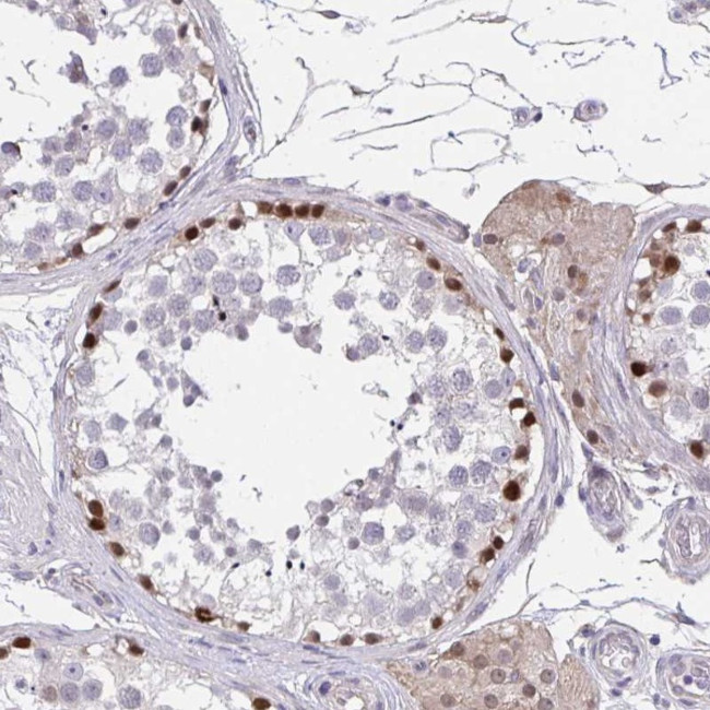 RHOXF1 Antibody in Immunohistochemistry (Paraffin) (IHC (P))