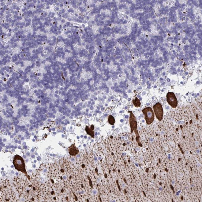 CDX4 Antibody in Immunohistochemistry (Paraffin) (IHC (P))