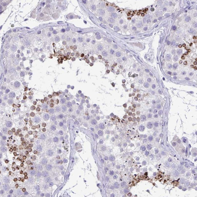 TMCO5A Antibody in Immunohistochemistry (Paraffin) (IHC (P))