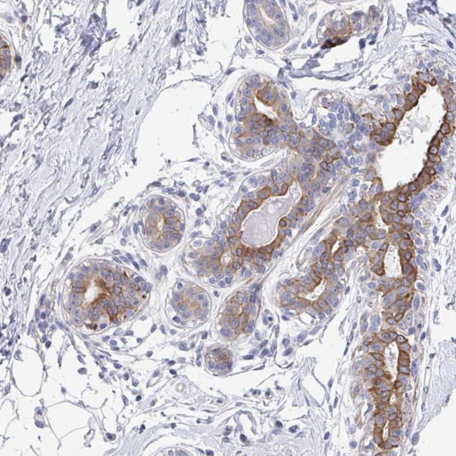 KLHL33 Antibody in Immunohistochemistry (Paraffin) (IHC (P))
