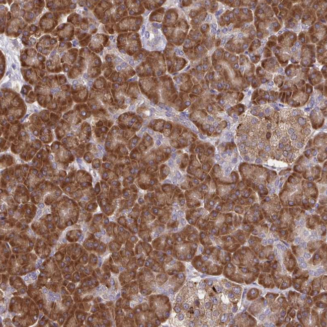 RPS7 Antibody in Immunohistochemistry (Paraffin) (IHC (P))