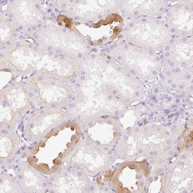 TAF1L Antibody in Immunohistochemistry (Paraffin) (IHC (P))