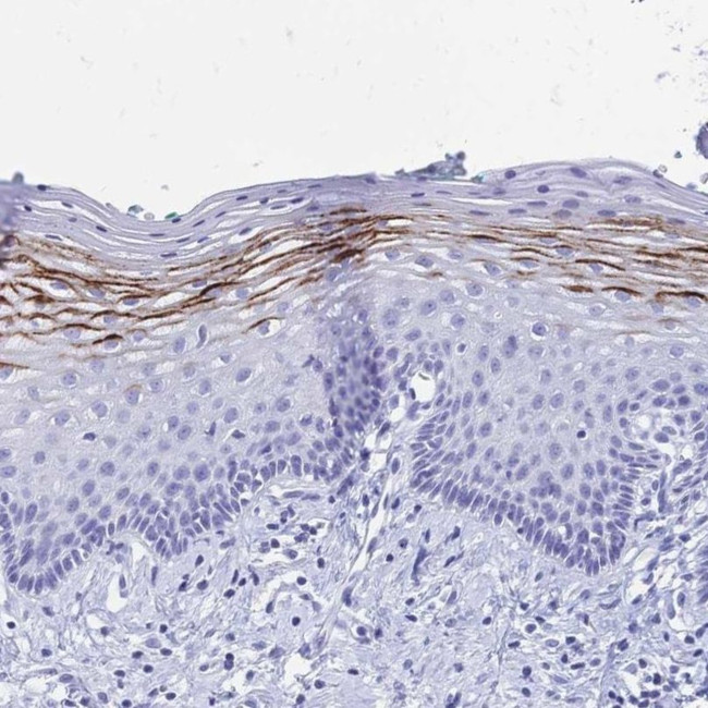 FA2H Antibody in Immunohistochemistry (IHC)