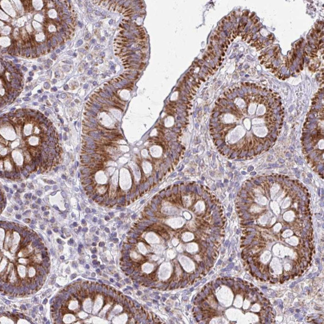 MRPL19 Antibody in Immunohistochemistry (Paraffin) (IHC (P))