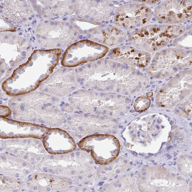 OR6N2 Antibody in Immunohistochemistry (Paraffin) (IHC (P))