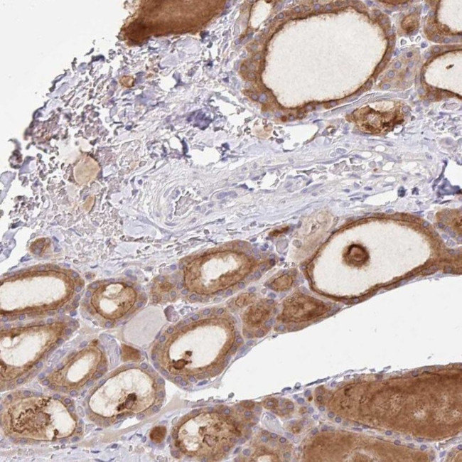 ZNF33A Antibody in Immunohistochemistry (IHC)