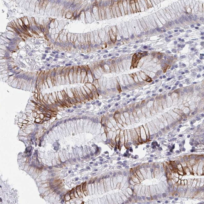 FA156 Antibody in Immunohistochemistry (Paraffin) (IHC (P))