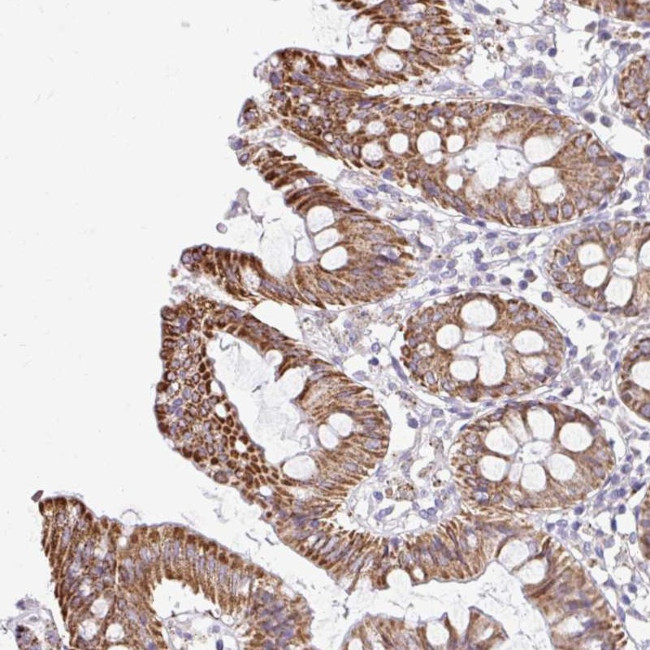 NT5C1B Antibody in Immunohistochemistry (Paraffin) (IHC (P))