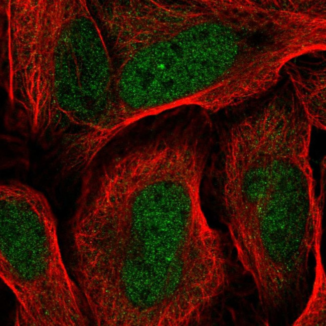 RDH14 Antibody in Immunocytochemistry (ICC/IF)