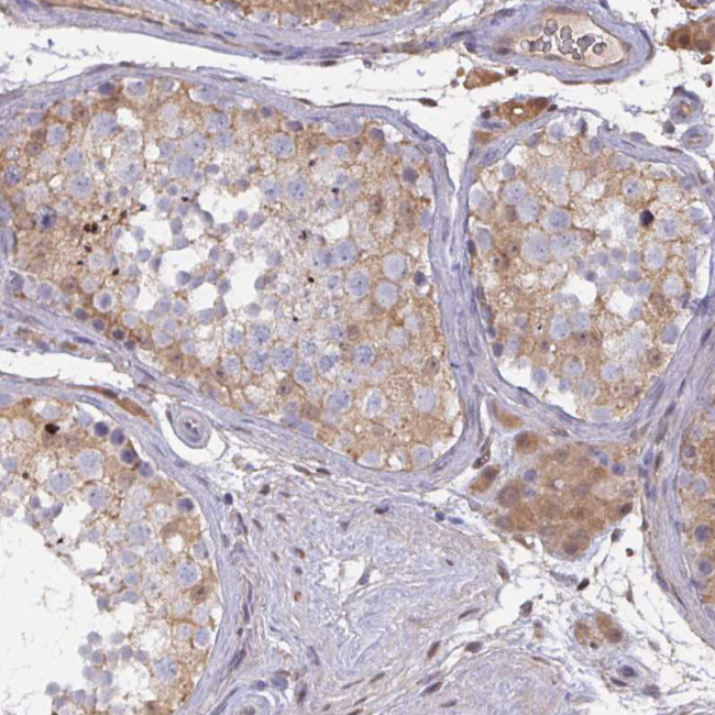 L3HYPDH Antibody in Immunohistochemistry (Paraffin) (IHC (P))