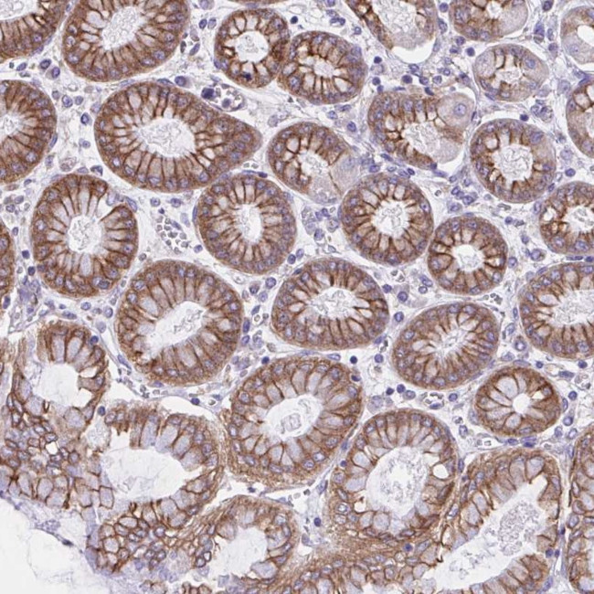 OR51M1 Antibody in Immunohistochemistry (Paraffin) (IHC (P))