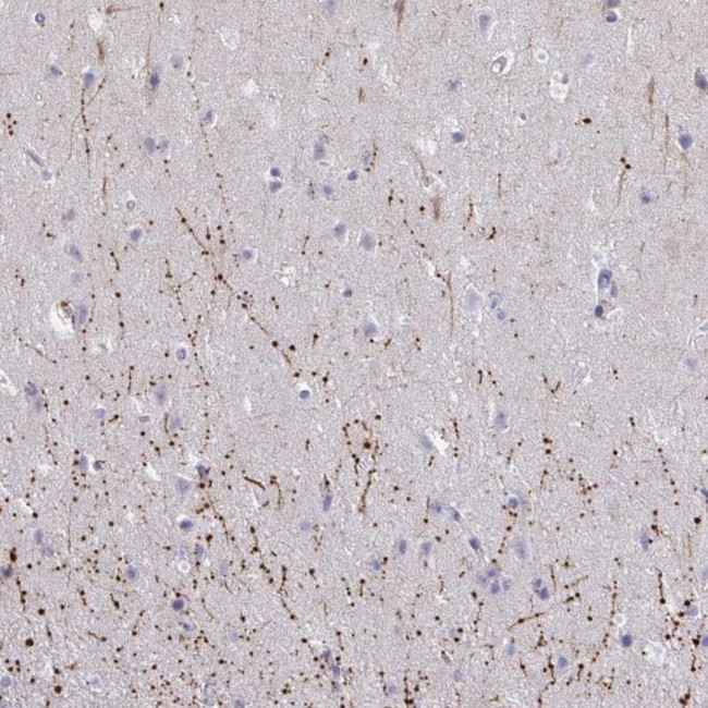 ARPP19 Antibody in Immunohistochemistry (Paraffin) (IHC (P))