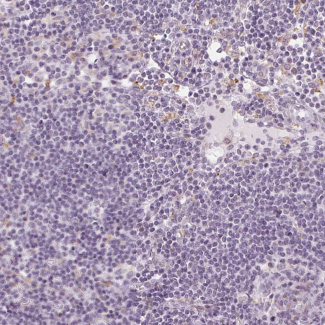 AIF1L Antibody in Immunohistochemistry (Paraffin) (IHC (P))