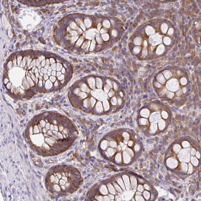 GFPT2 Antibody in Immunohistochemistry (Paraffin) (IHC (P))