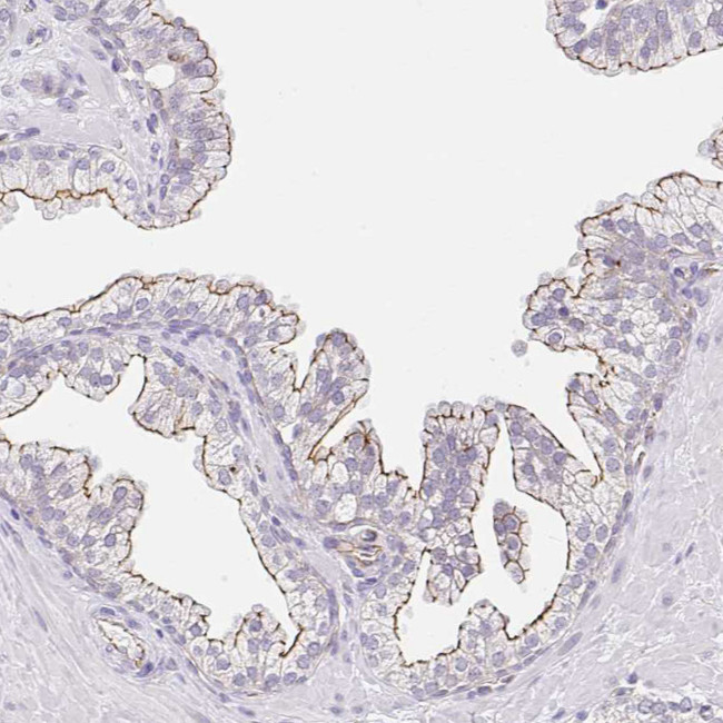 CGNL1 Antibody in Immunohistochemistry (Paraffin) (IHC (P))