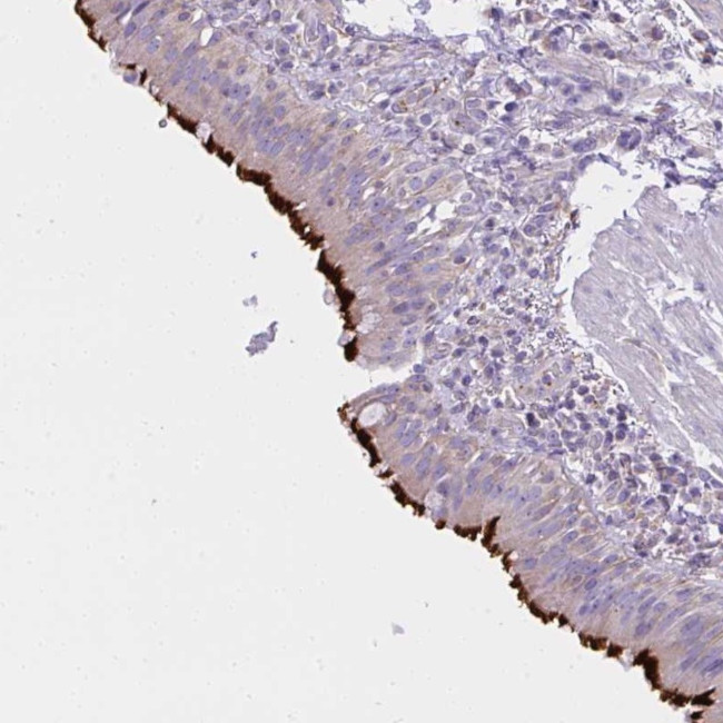 CCDC142 Antibody in Immunohistochemistry (Paraffin) (IHC (P))